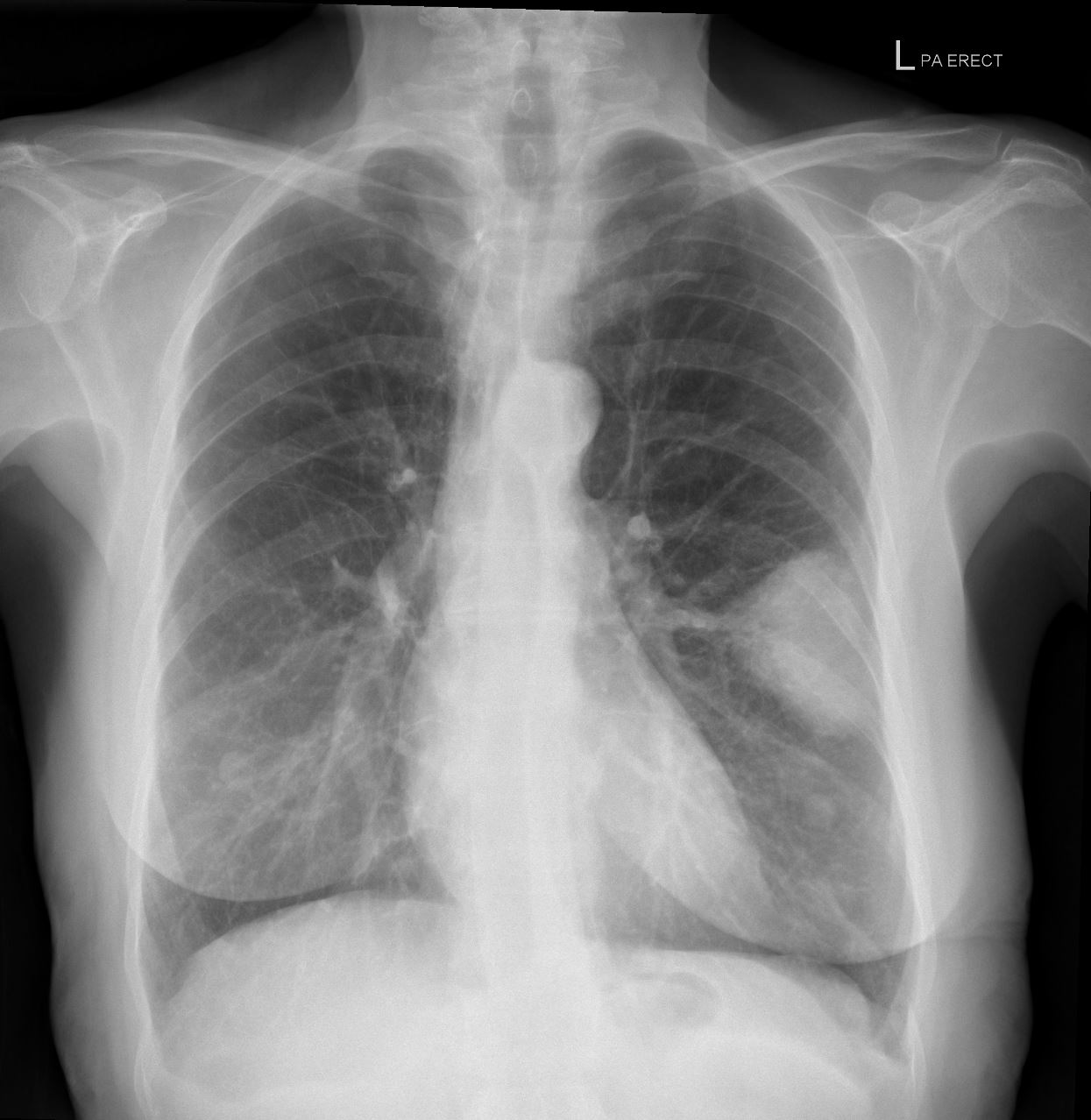 Case 2